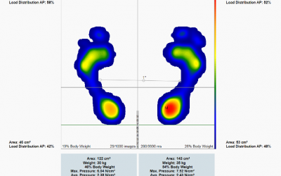 Static Analysis 👣 What is it? Why is it so important?
