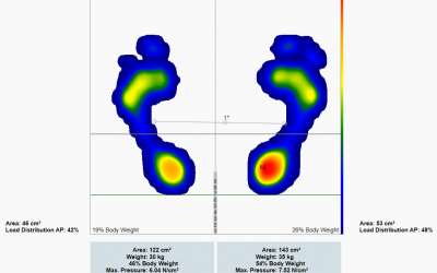 Análise Estática 👣 O que é? Porque é tão importante?